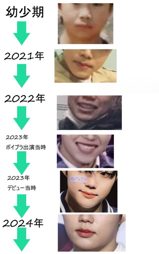 パクゴヌクの口元や輪郭変化の比較画像