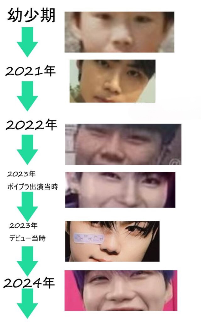 パクゴヌクの鼻の変化の比較画像