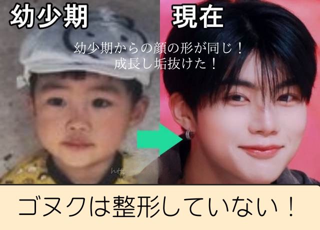 パクゴヌクの整形比較画像