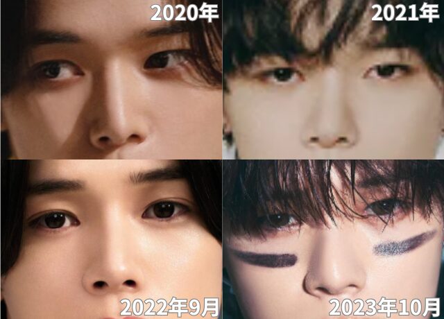&TEAMのKの鼻の変化